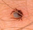 tick-on-skin-744818.jpg